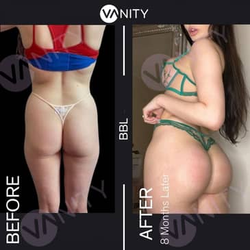 Slider image (4) Vanity Cosmetic Surgery Hospital